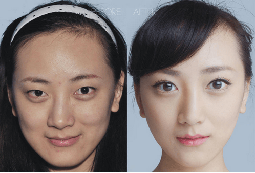 plastic surgery in China